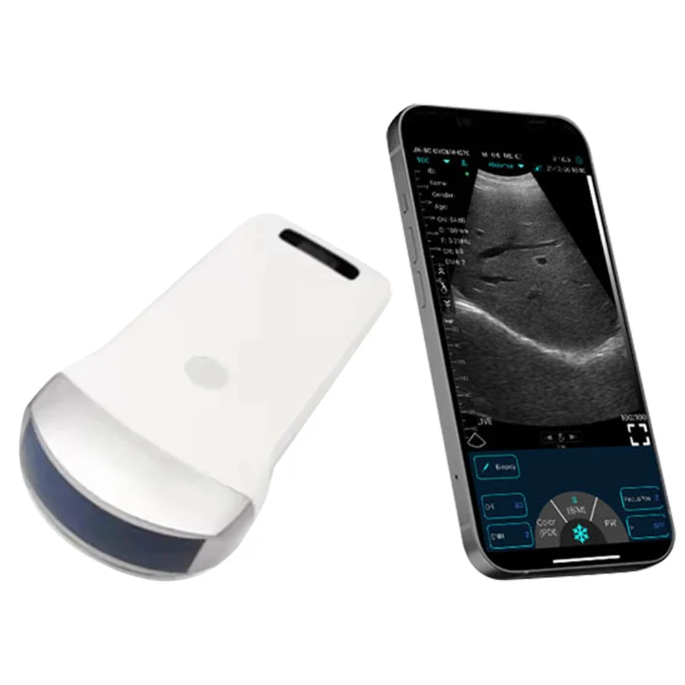 80 Elements Wireless Probe Type Ultrasound Scanner Frequency 3.5Mhz B&W Abdomen Ultrasound Basic Convex Probe