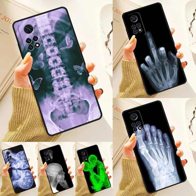 

Чехол X-RAY Radiological Skeleton для Samsung Galaxy S24 Plus S23 S20 S21FE Lite S22 Ultra Note 20 S8 S9 S10 Phone Coque