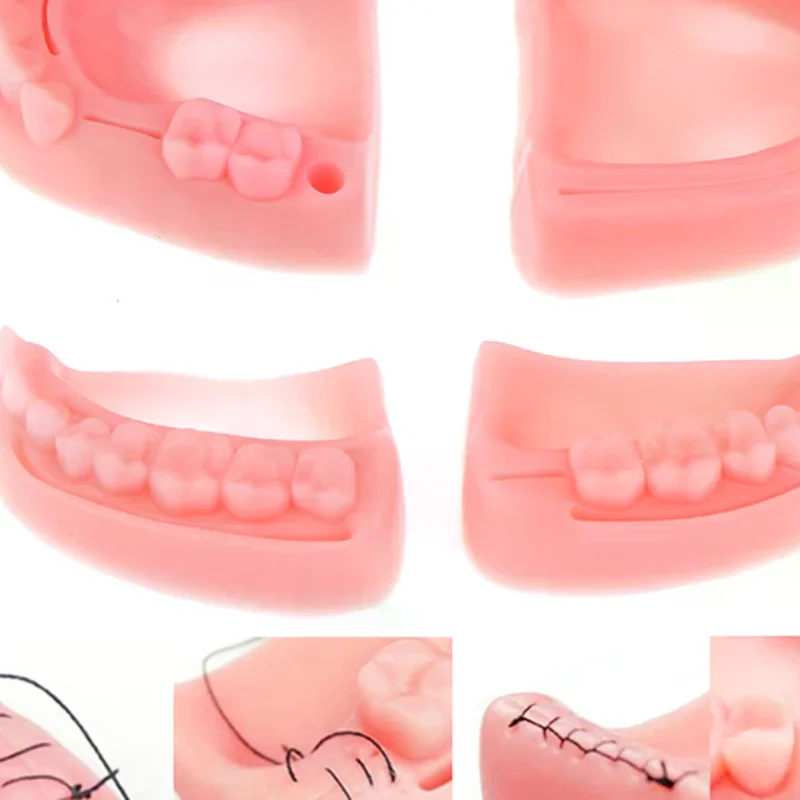 

Набор из 4-х модулей для обучения наложению медицинских швов: мягкая модель десны из пищевого силикона, стоматологическая модель, учебное оборудование