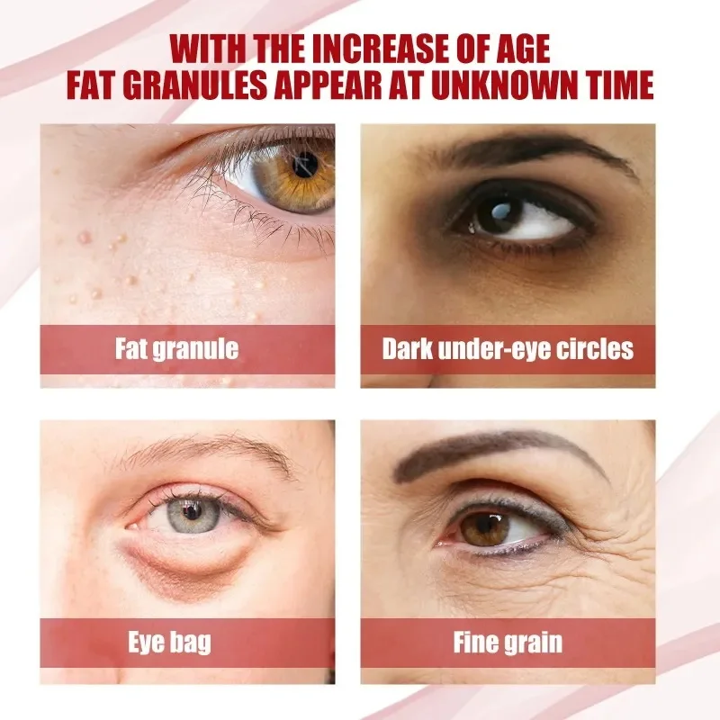 Anti Dark Circle Eye Cream Fat Granules Removal Cream Anti-Wrinkle Lifting Moisturizing Firming Anti-Puffiness Korean Skin Care