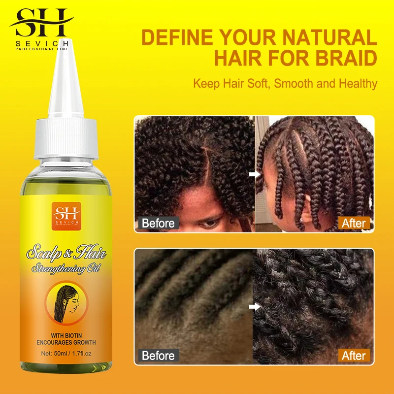 2023 new 50ML Hair Antipruritus Growth Oil for braids protective hairstyles relieve itchyand flaky scalp prevent hair loss