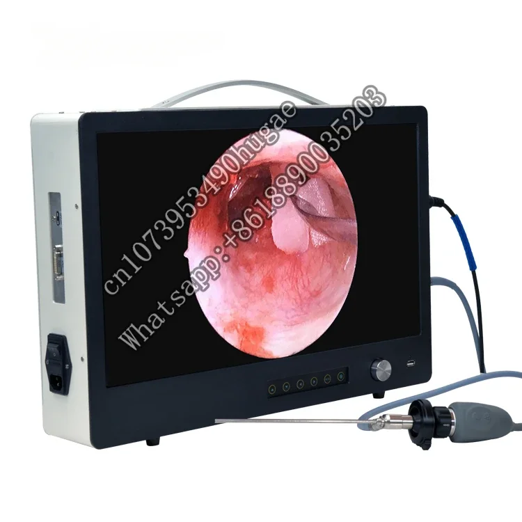 Portable integrated arthroscope hysteroscope laparoscope HD