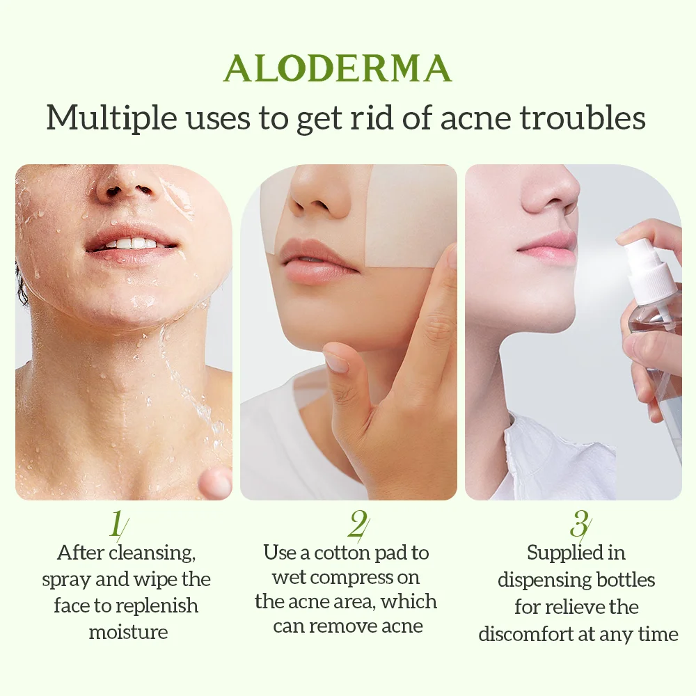 ALODERMA Men Aloe Acne Removing Toner Man Gently Controls Oil Essence Water,Natural Non-Irritating,Soothes Pores 135ml