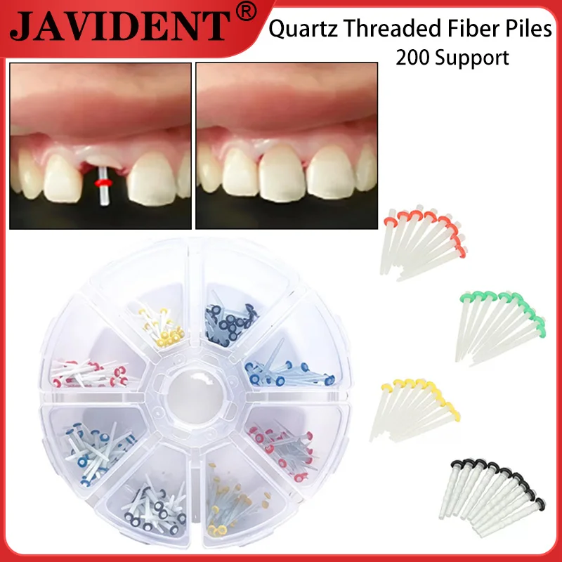 

200 шт./кор. стоматологические волокна, сверла с резьбой, прямые стойки, кварцевое стекло, наборы с резьбой, материалы для восстановления корневых каналов