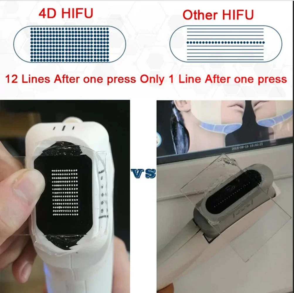 3D/4D HIFU 11-12 Lines Ink Cartridge Multiple Sizes Available 1.5 3.0 4.5 6.0 8.0 10.0 13.0 16.0 Choose Your Perfect Fit