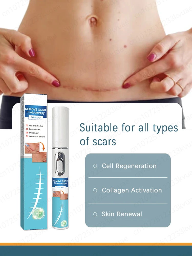 レーザー傷跡除去、あらゆる種類の傷跡に適しており、安全で健康的な傷跡除去