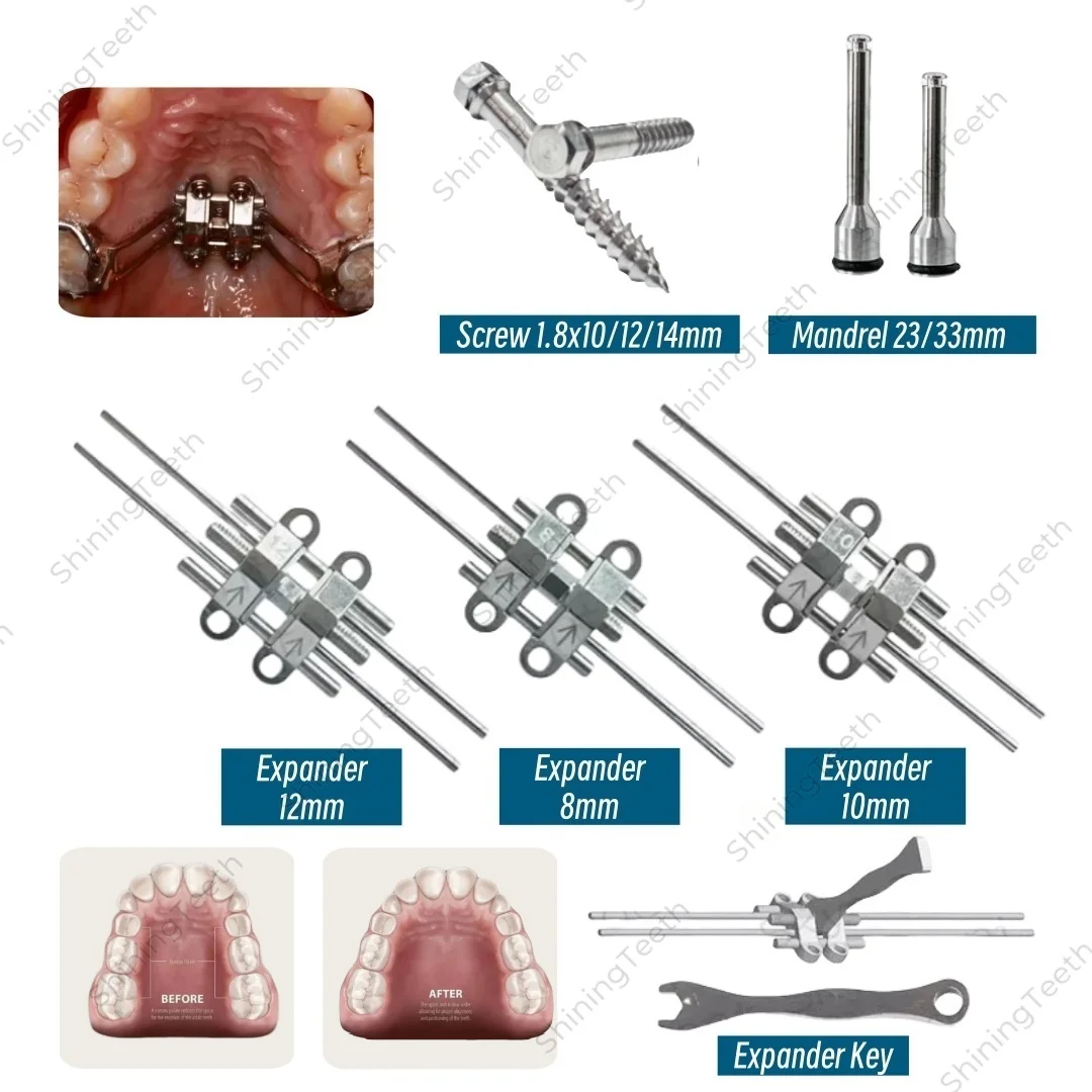 

MSE верхнещелепный скелетный расширитель, стоматологическая ортодонтия, расширительный винт для лица, быстрый разделенный Hyrax, 8 мм/10 мм/12 мм, нержавеющая сталь