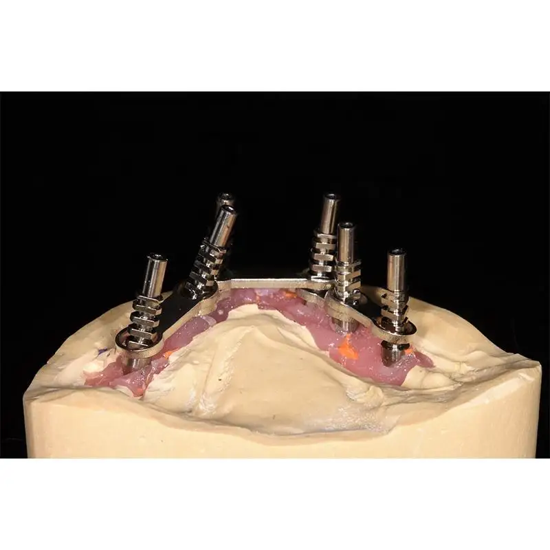 Wszystko na 4 protezach dentystycznych Implant metalowy obsługiwany pasek Overdenture