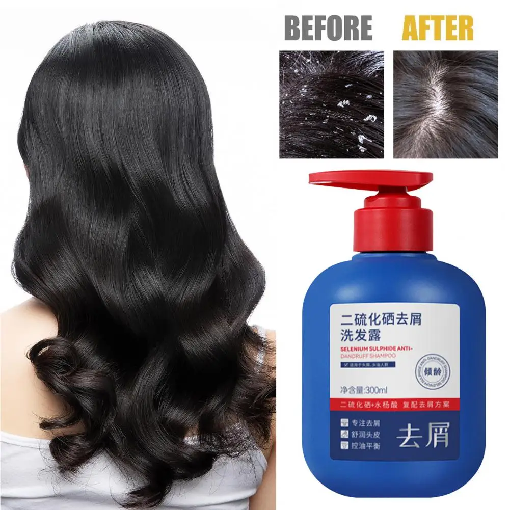 

300ML Selenium Sulfide Anti-Dandruff Shampoo Hydrating Dandruff Removal OilControl Salicylic Acid Hair Cleansing Care Shampoo 95