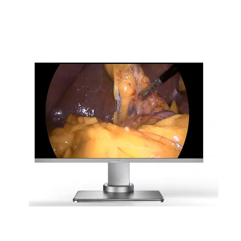 

4k 27inch medical grade endoscope monitor display