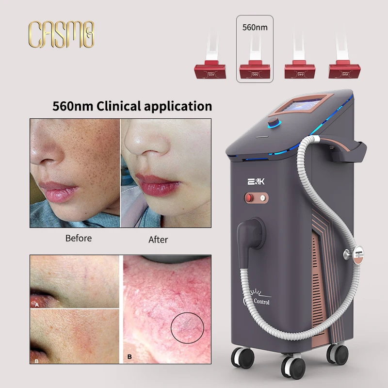 

TT PLASTIC BEAUTY skin care Anti inflammatory red blood streaks whitening