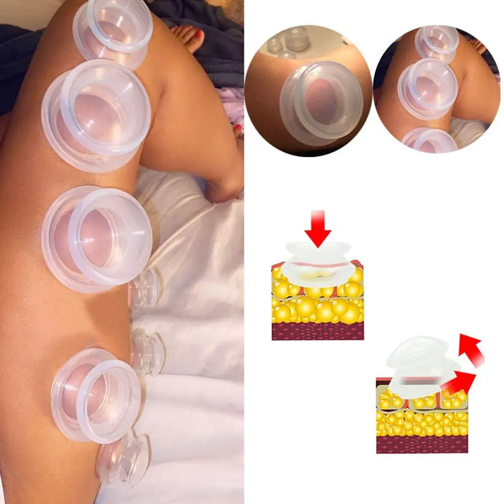 4PCS Silicone Vacuum Cupping Set Massage Body Cups Back Gua Sha Suction Cup Skin Lift Physiotherapy Jars Slim