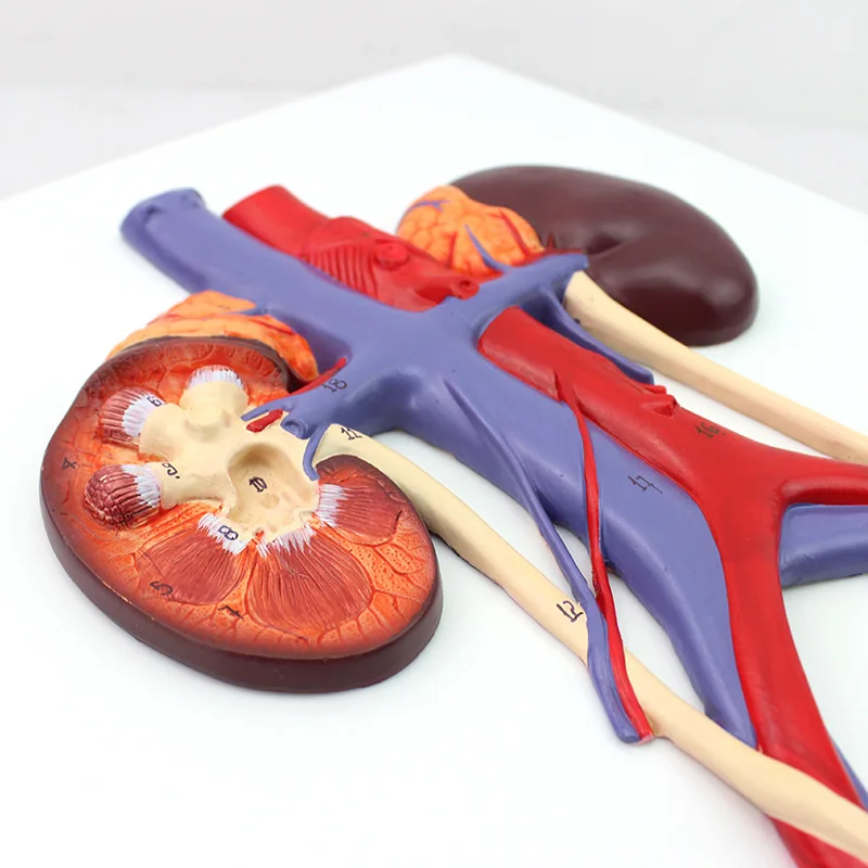 Human Anatomy Bladder Catheterization Renal Urinary System Model Kidney Arteriovenous Model Medical Teaching