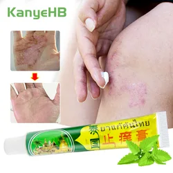 1Pcs Herbal Psoriasis Cream Eczema Dermatitis Chinese Ointment Works Perfect For All Kinds Of Skin Problems Body Care Cream S074