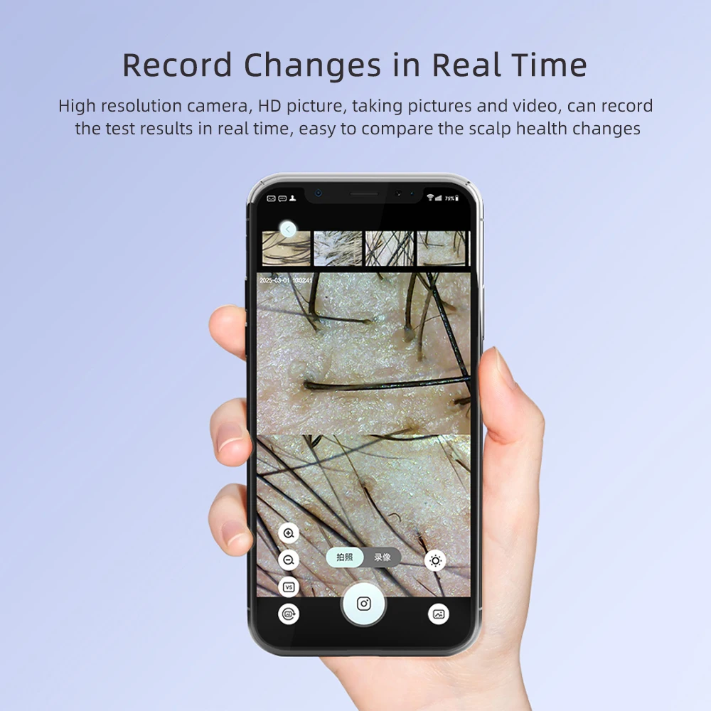 新しい50X-200X毛包頭皮検出器皮膚分析器顕微鏡ツール高解像度皮膚テスターサポートAPPワイヤレス使用