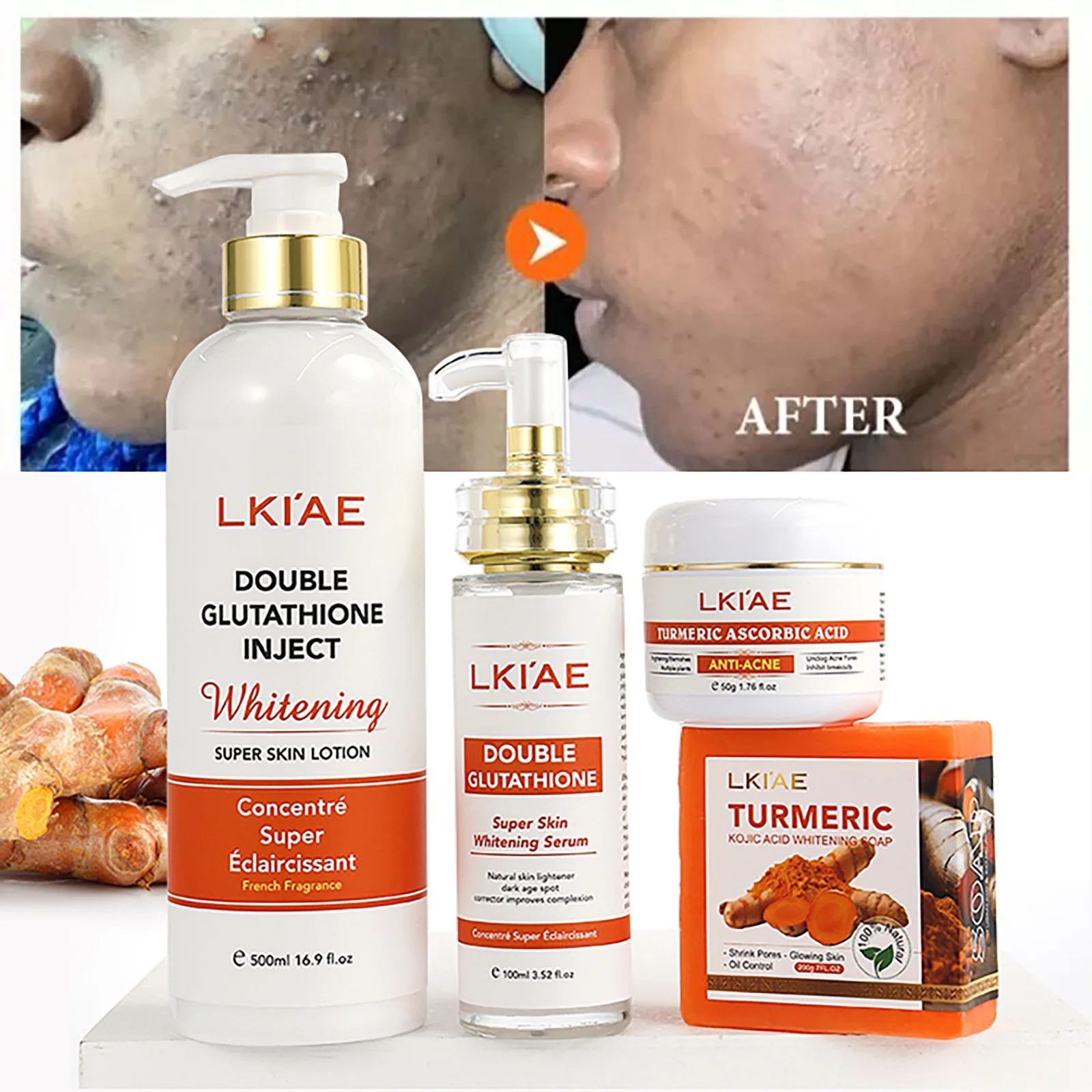 Clareamento e Acne Remoção Faixa, glutationa, açafrão Natural, Hidrata Profundo, Limpa e suaviza a pele