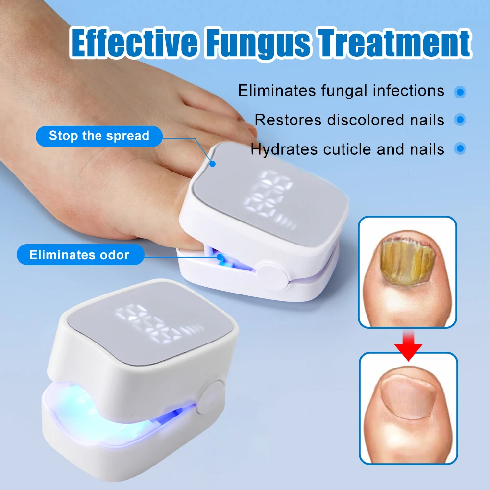 LCD Display Fungal Nail Laser Device Repair Toenail Nails Fungus Onychomycosis Nails Fingernail Effectively Removes Nail Fungus