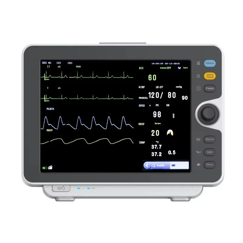 Smart Vet Multi-parameter Veterinary Patient Monitor 6-Channel Monitor 12-inch Color TFT Display Electric WiFi Enabled