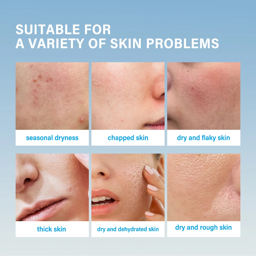 Super Hydrating Cream Moisturizing Facial Skin Dry Long-lasting Moisturizing Restoring Skin Barrier Suitable For All Skin Creams