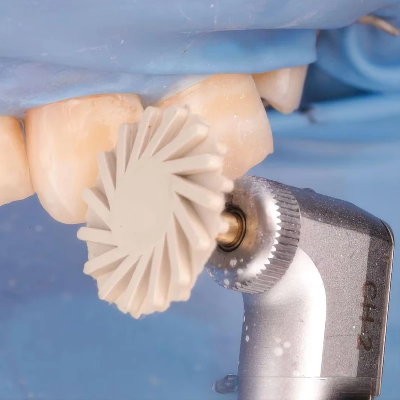 8-teiliges Dental-Gummi-Polierset, 2-Stufen-Diamantpolierer, RA-Keramik-Restaurations-Schleifset, Spiral-Flex-Radbürste für Zahnmedizin – Detail 5