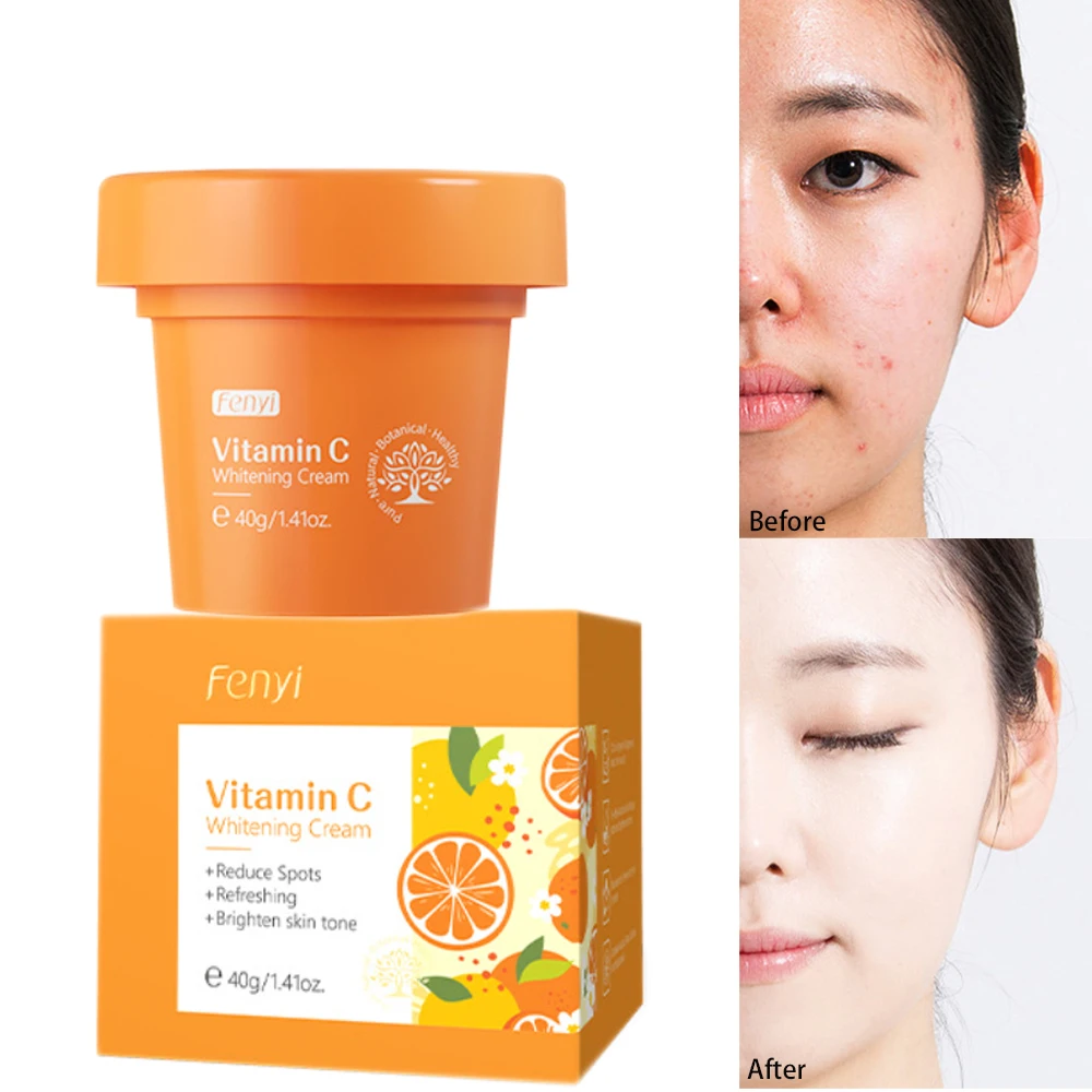 Vitamina C Para Rostro Bleaching Whiting Day Facial Cream Crema Faciales Alta Gama Cremas Aclarantes De Piel Cicatrices Eliminar