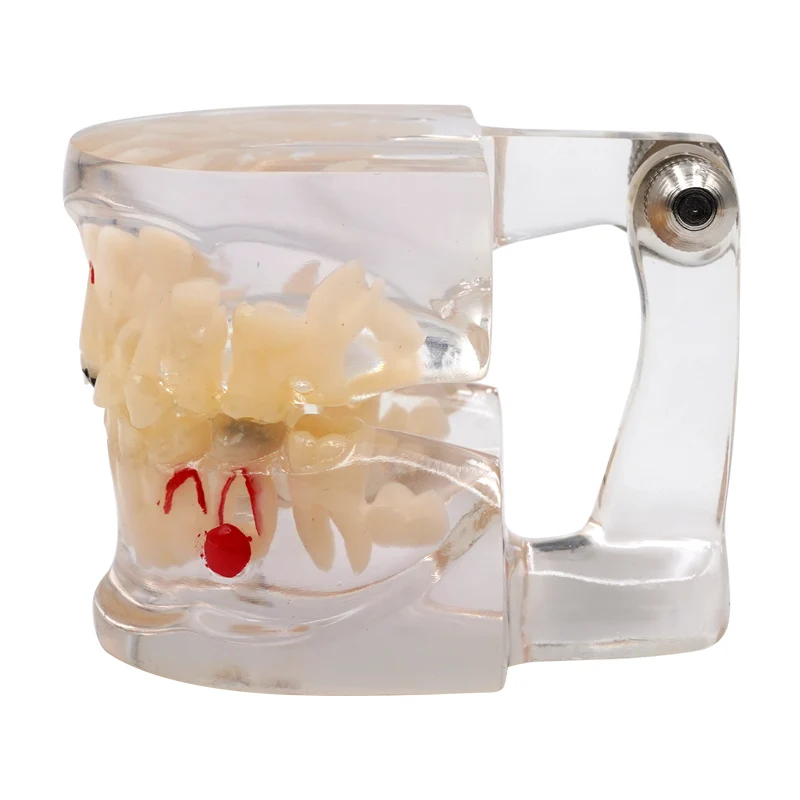 

Модель зубных зубов, детская молочная постоянная альтернативная модель, детское молоко, демонстрационная демонстрация для постоянного исследования, стандартная студенческая модель стоматолога