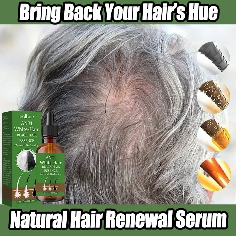 

2N Gray To Black Hair Oil Reduces Premature Graying Nourishes Follicles Restores Natural Black Pigment Darkening Gray/white