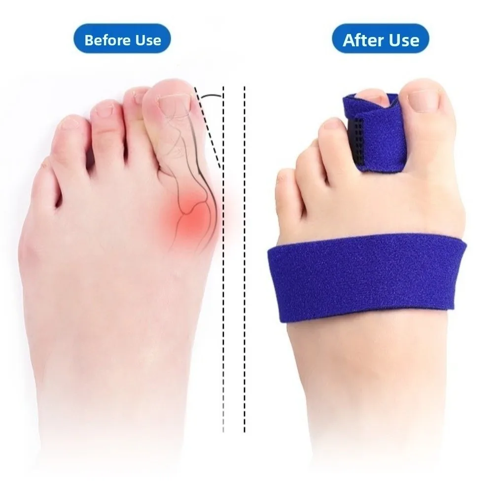 Adjustable Finger Brace Trigger with Fastening Strap Comfortable Finger Splint Broken Mallets Breathable Built-in Aluminum Bar