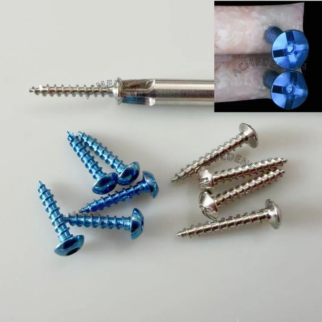 sistema-de-fijacion-con-tornillos-para-injertos-dentales-gbr-tornillos-para-estabilizar-bloques-Oseos-y-injertos-en-rodajas