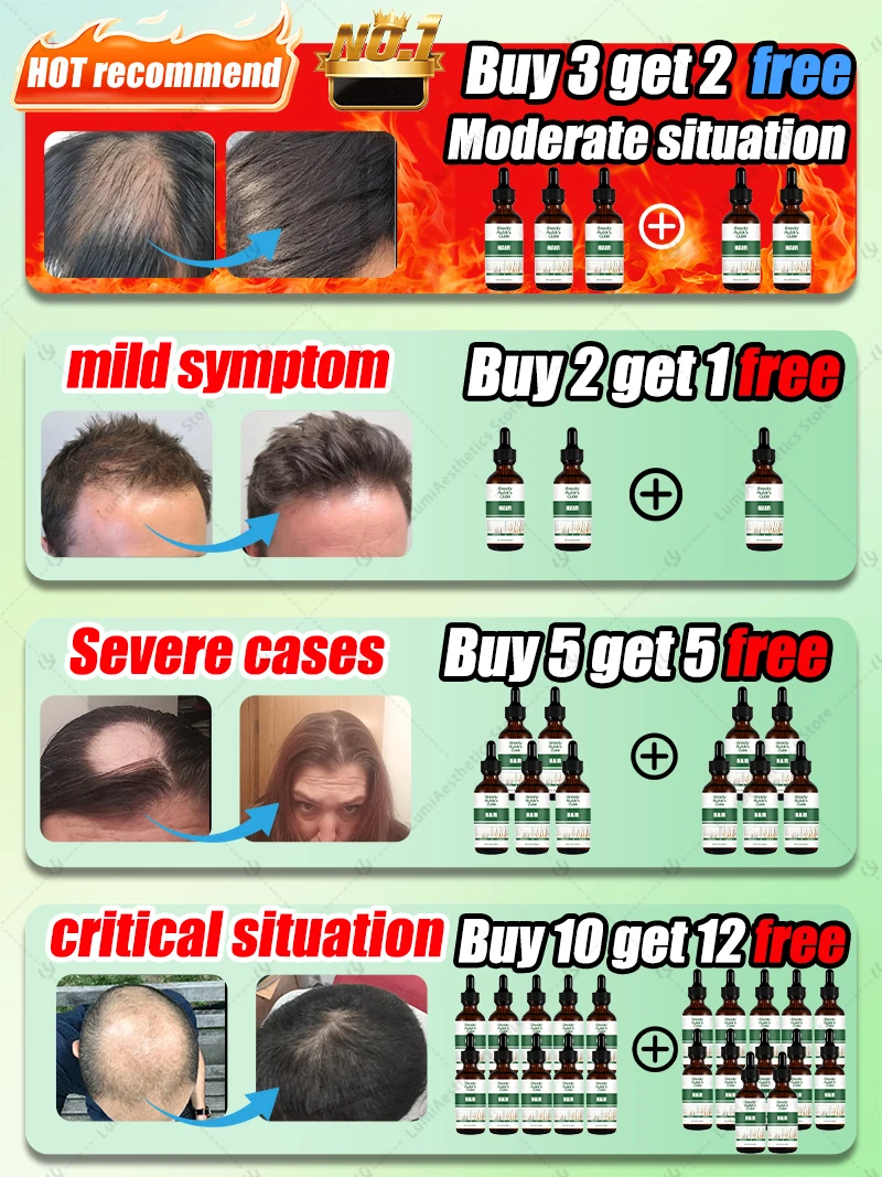 ᵀʰⁱⁿⁿⁱⁿᵍ ʰᵃⁱʳ ⁱˢ ⁿᵒ ˡᵒⁿᵍᵉʳ ᵃ ᵖʳᵒᵇˡᵉᵐ‧ ᶜʰᵒᵒˢᵉ ᵒᵘʳ ʰᵃⁱʳ ᵍʳᵒʷᵗʰ ᵖʳᵒᵈᵘᶜᵗˢ ᵗᵒ ᵐᵃᵏᵉ ʸᵒᵘʳ ʰᵃⁱʳ ᵗʰⁱᶜᵏᵉʳ ᵃⁿᵈ ˢᵗʳᵒⁿᵍᵉʳ‧