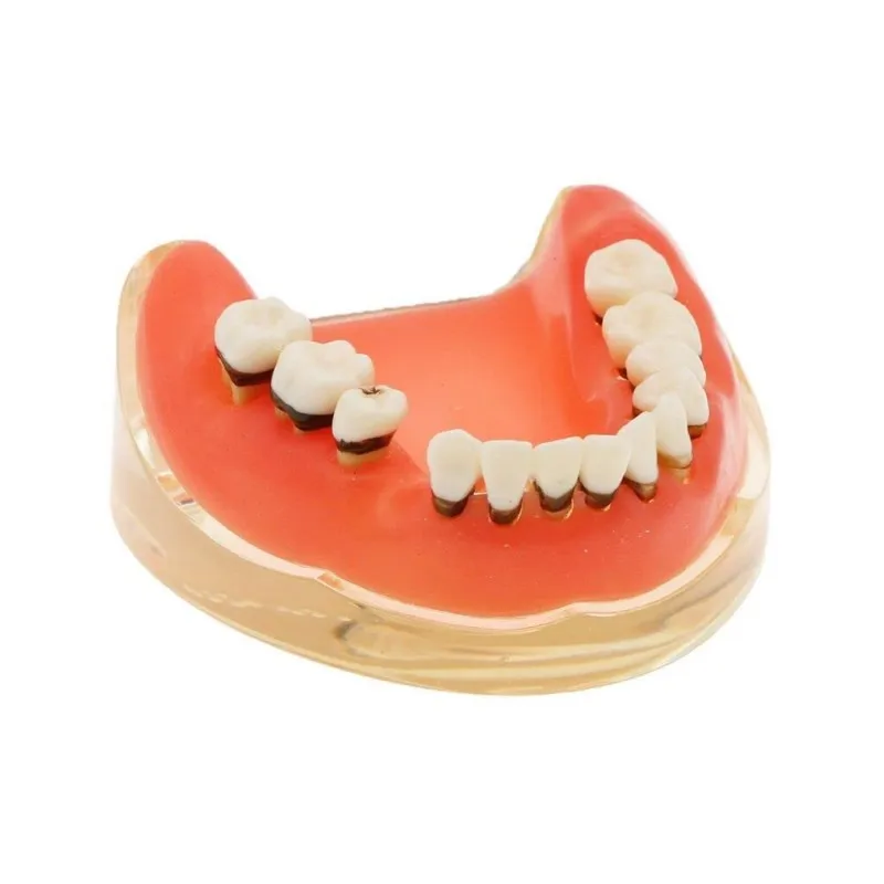 PIORPOYDental Teaching Model Pathological Periodontal Disease Study Teeth Mold Dentistry Education Students Training Tools M4017