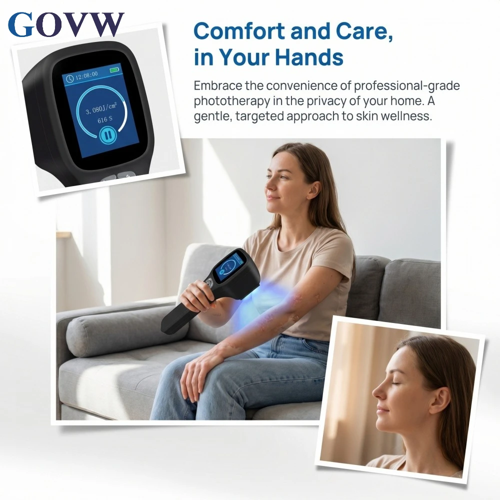 GOVW 308nm Excimer Targeted Light Therapy Handheld Uvb phototherapy Device for Vitiligo Psoriasis Dermatitis Treatment 49Diodes