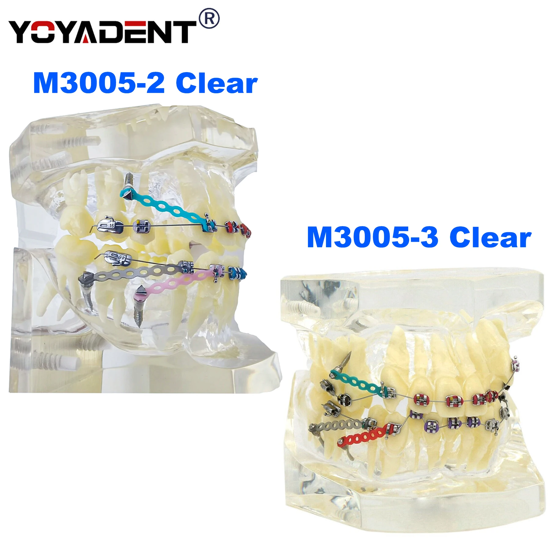 

Dental Teeth Model For Orthodontics treatment study Teaching Demo Model