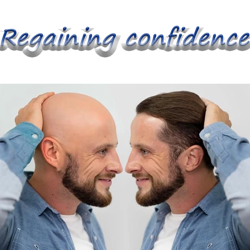 

Toupee Injected Wig I Skin Replacement Male Hair Prosthesis 6'' 100% Human Hair Wigs Exhaust Prosthetic Hair For Men