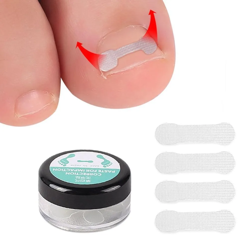 10PCS Ingrown Toe Nail Treatment Ingrown Toenail Correction Tool Elastic Patch Sticker Straightening Clip Brace Pedicure Tools