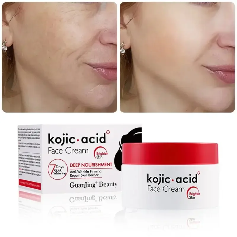 Crème pour le visage à l'acide kojique, 50g, 7 jours, éclaircissante, hydratante, élimine les taches de rousseur, soin coréen, nourrissant en profondeur