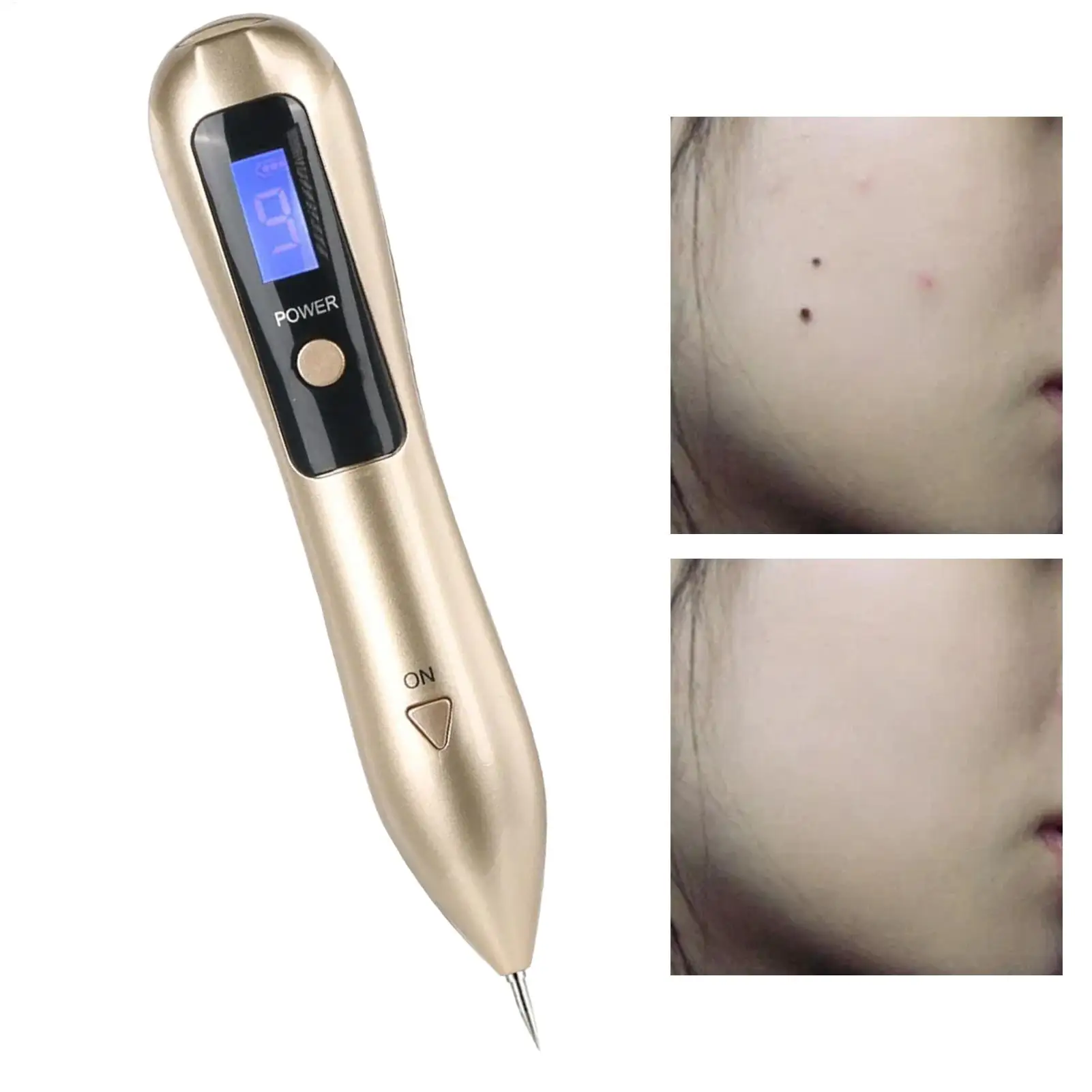 

Портативный перезаряжаемый косметический аппарат Beauty Pen: микроигольчатая ручка для ухода за кожей лица, макияжа, для женщин и мужчин, для ежедневного использования, путешествий и салонов
