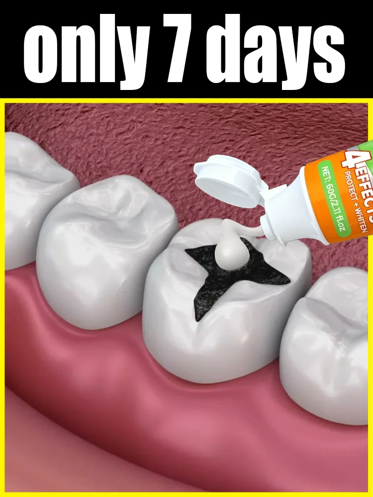 

Eᴀsɪʟʏ ʀᴇɢᴇɴᴇʀᴀᴛᴇ ɢᴜᴍs ᴀɴᴅ ᴄᴏᴠᴇʀ ᴛᴇᴇᴛʜ ɪɴ 7 ᴅᴀʏs