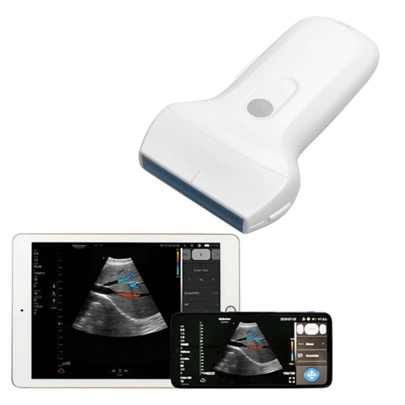

Portable Ultrasound Machine &wireless Probe for Phone/pad