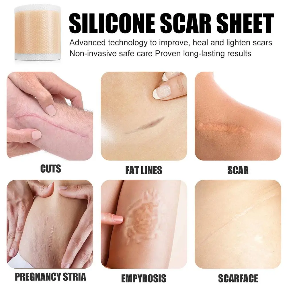 Premium Silicone Scar Sheets Silicone Scar Tape 1.6”x 60” Scar Removal Strips for Acne Scars C-Section Scalable Scar Cover