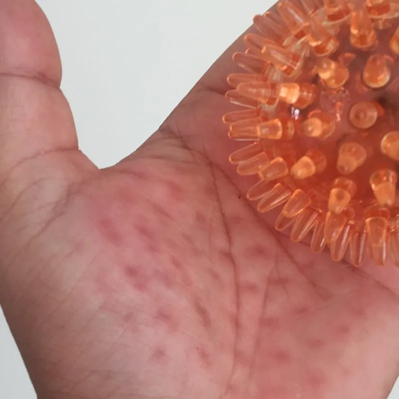 

Колючий мяч, полый, мягкий, прозрачный, для восстановления силы, для снятия стресса, массажный мяч для рук, запястья