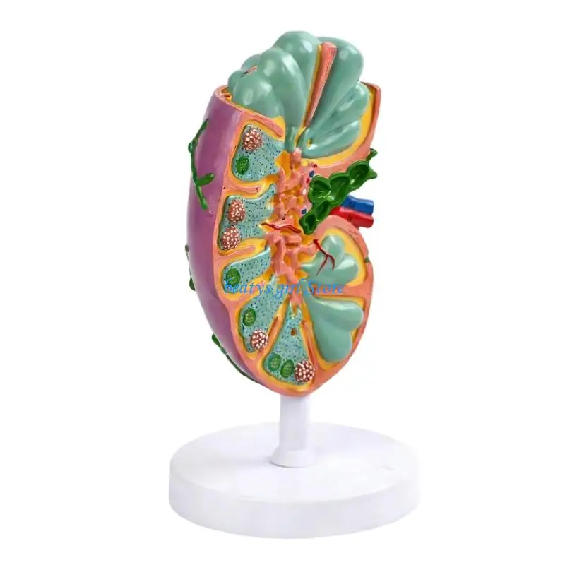 C7AB Anatomical Human Lymphatic Structure Model Teaching Aid for Clinical Training
