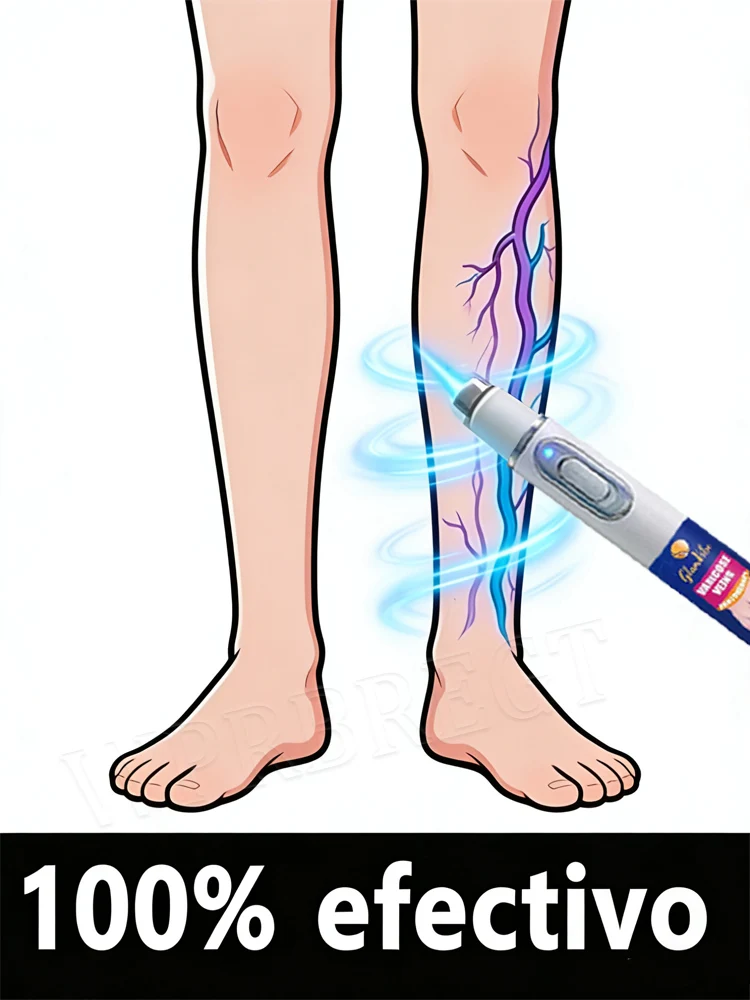 

95% of varicose vein patients purchase