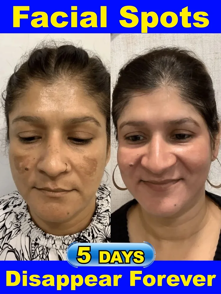 

Effectively solve all facial symptoms of dark spots and pigmentation