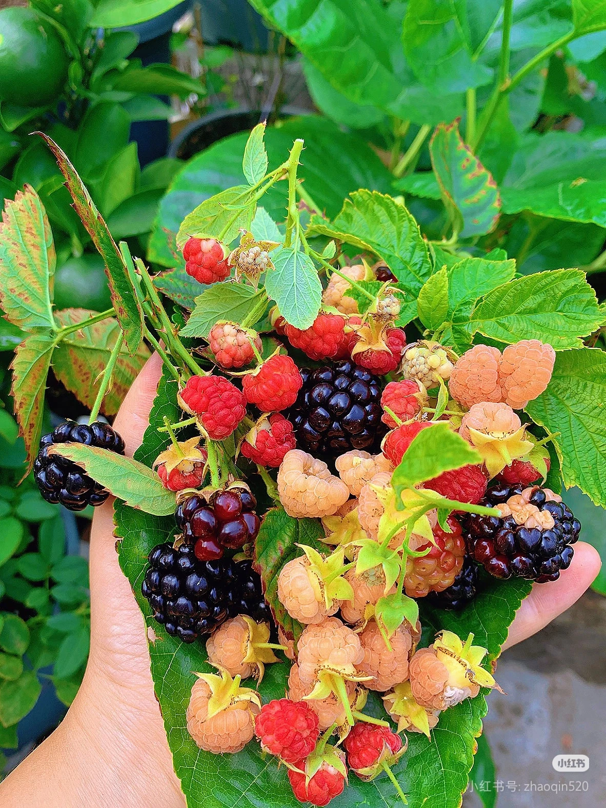 

2026 Latest High-Power Diode Laser Hair Removal Device with Four Wavelengths for Permanent Hair Removal