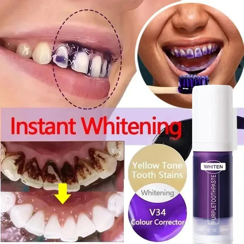 

V34 Зубная паста для отбеливания зубов 5D полоски для отбеливания зубов гигиена полости рта чистка инструменты для отбеливания зубов свежее дыхание уход за стоматологией