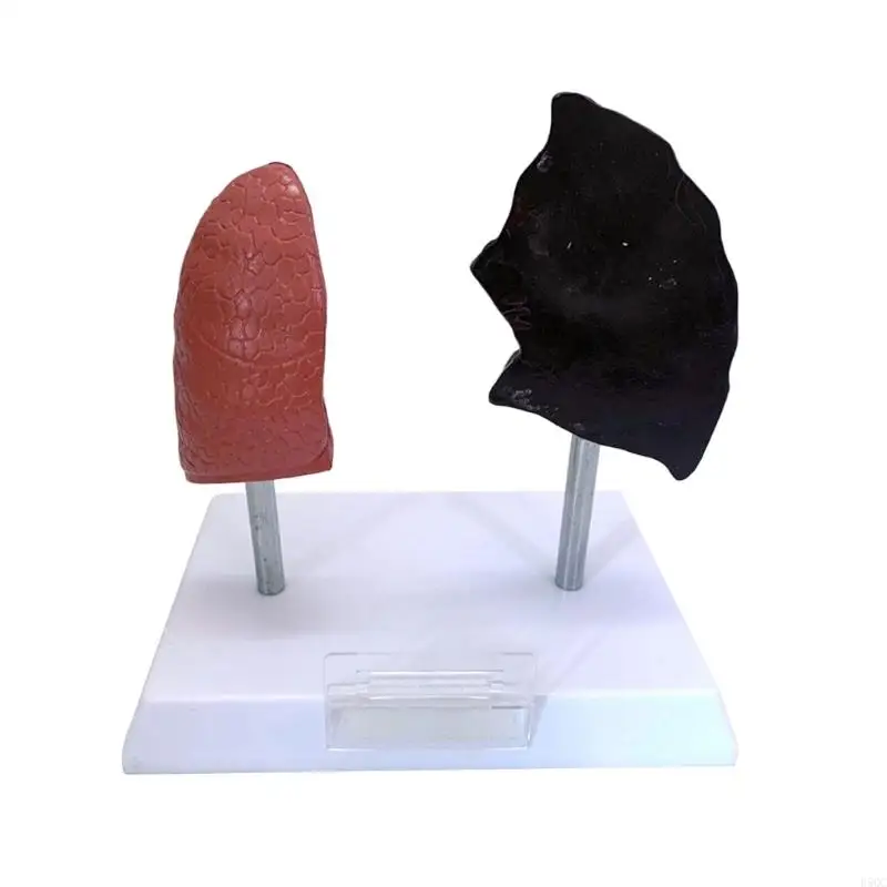 نموذج تباين الرئة القابل للنقل المدخن مقابل المعدات التعليمية السريرية الصحية PVC D5QC