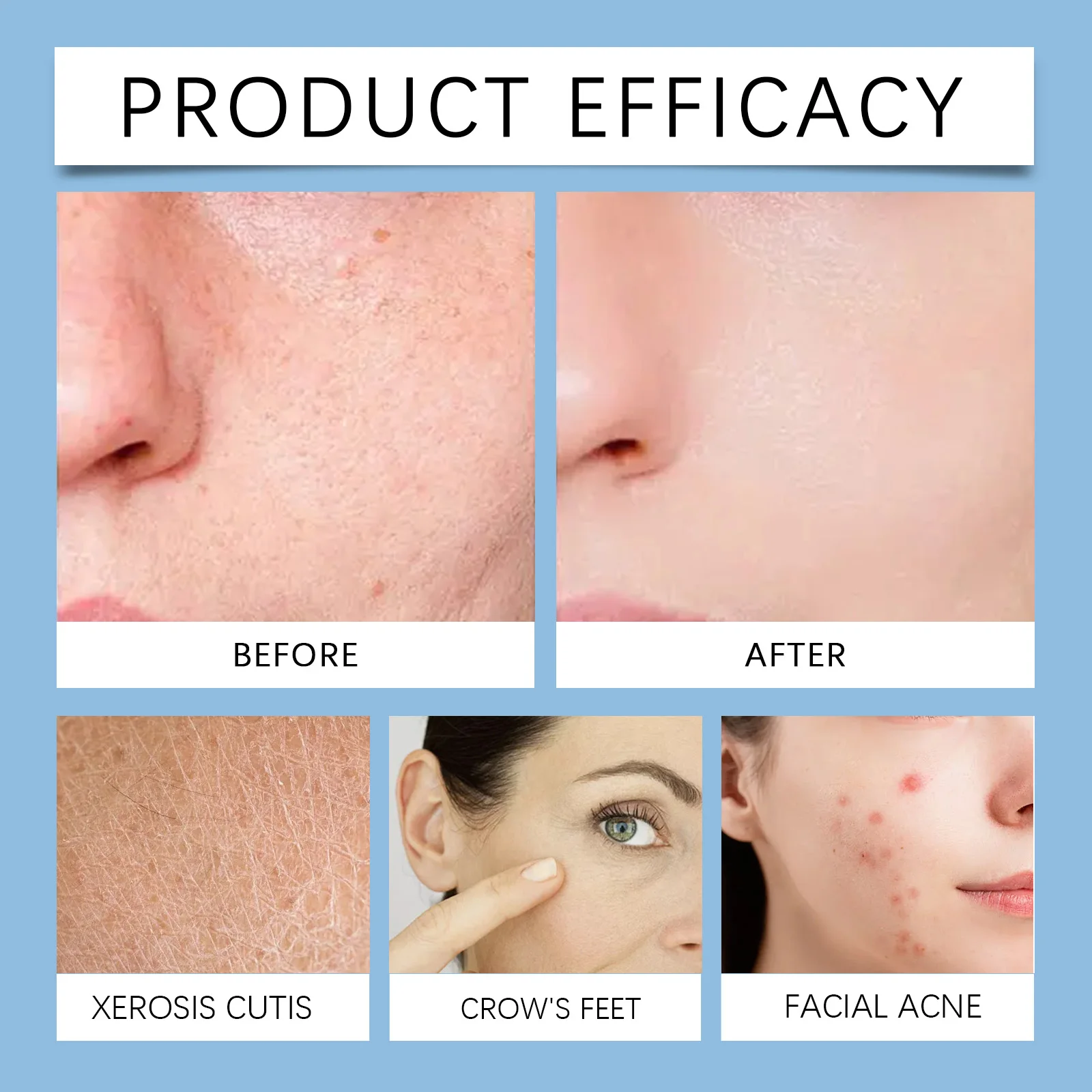 Thumbnail 2 - #19 Top Toners Picks for Every Budget