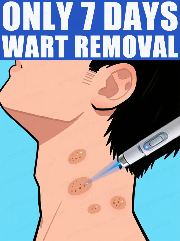 

2nd ᵍᵉⁿᵉʳᵃᵗⁱᵒⁿ ᵘᵖᵍʳᵃᵈᵉᵈ wᵃʳᵗ ⸴ ʳᵉpᵃⁱʳ wᵃʳᵗˢ ʳᵒoᵗ ⸴ ᑫᵘⁱᶜᵏˡʸ