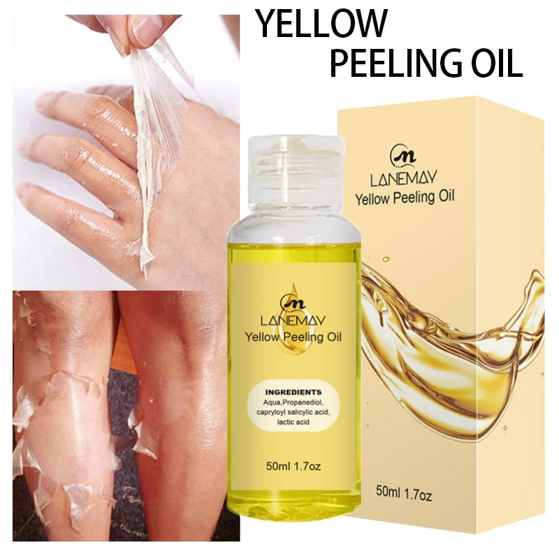 

Strong Yellow Peeling Oil Bleach Dark Skin Whiten Lotion Lighten Body Elbow Knee Hand Exfoliate Dead Skin Nourish Even Skin Tone